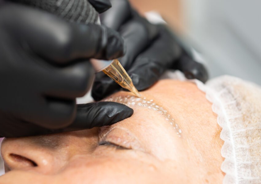 tehnologii_sectiunea 3.3