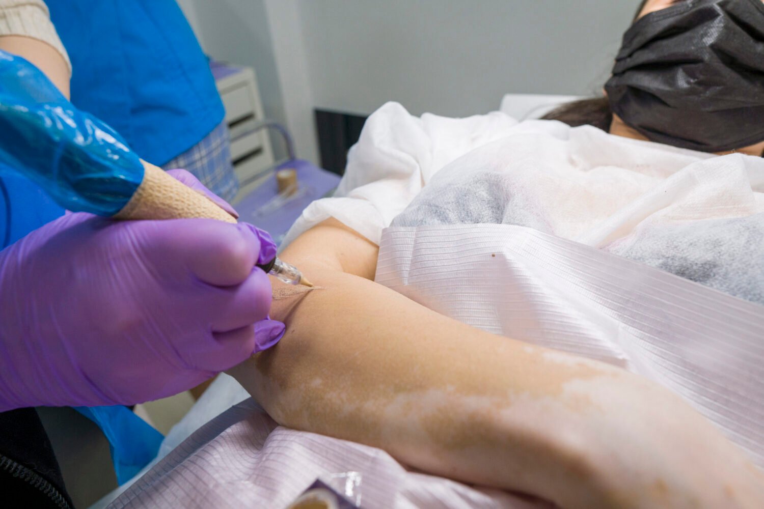 Pigmentari Medicale Cicatrici