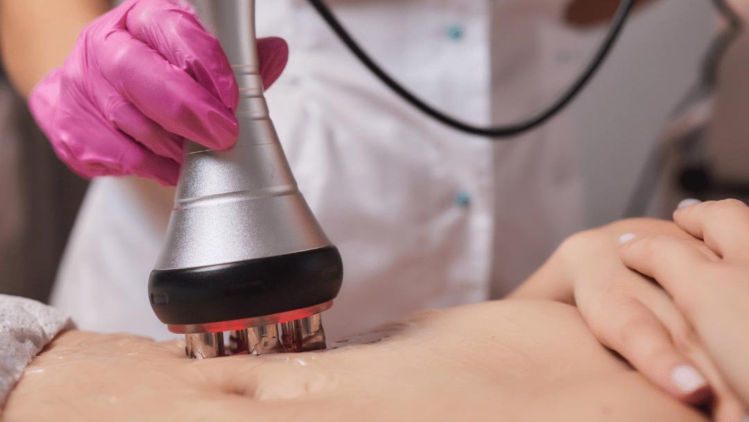 Radio-Frequency-Body-Treatment-RF-Aesthetic-clinic-dubai-1.jpg