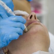 Curs Microdermaziune