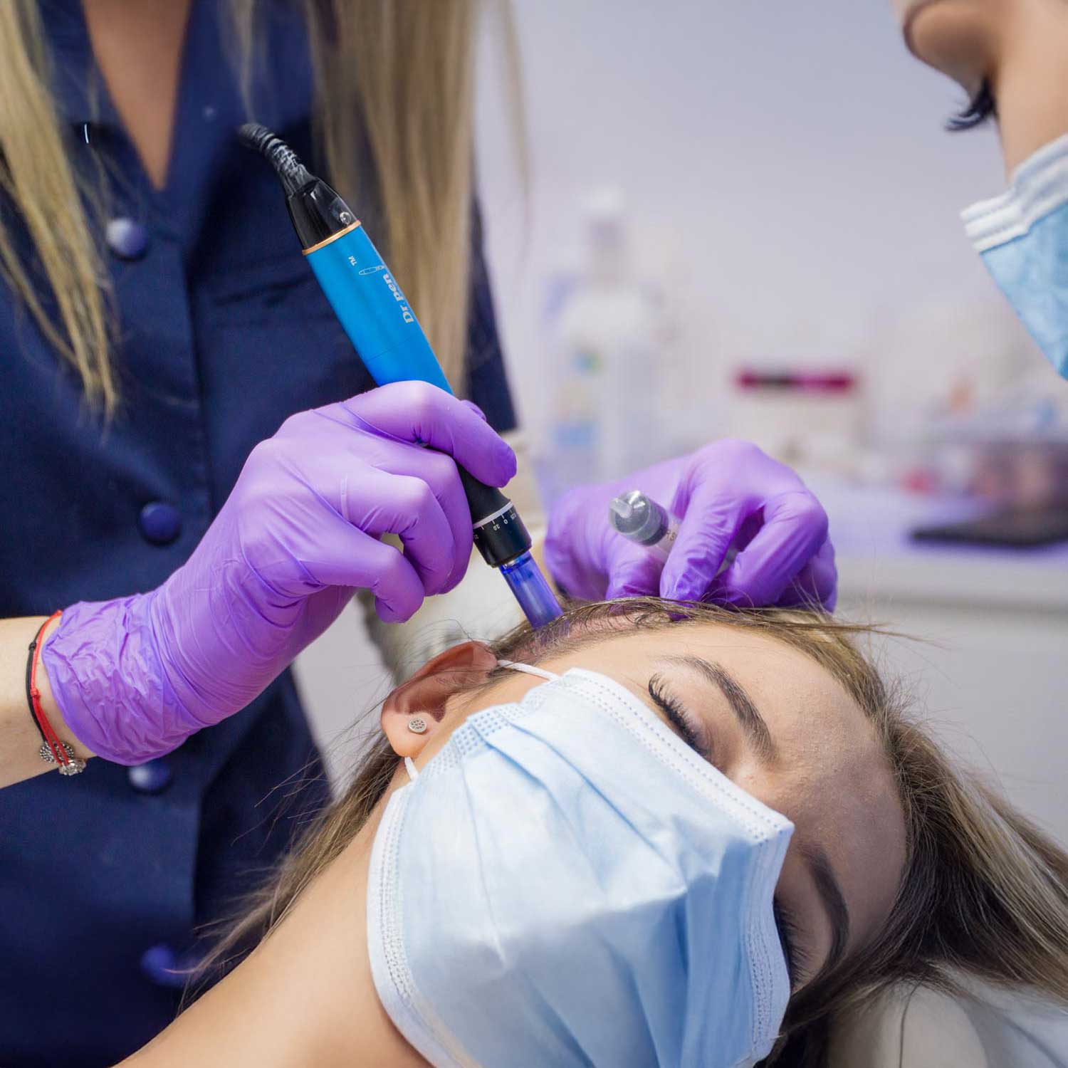 Curs Microneedling Scalp