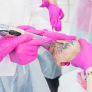 Curs Stergere Tatuaje  Acreditat Laser