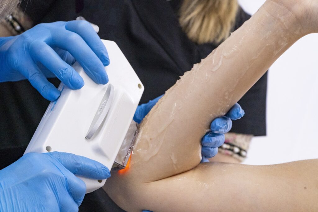 Curs de laser la Colegiul de Estetică