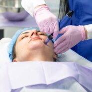 Curs Microneedling